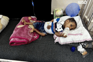 UN Warns Child Malnutrition in Gaza Nears 95,000 Cases as Winter Worsens Crisis